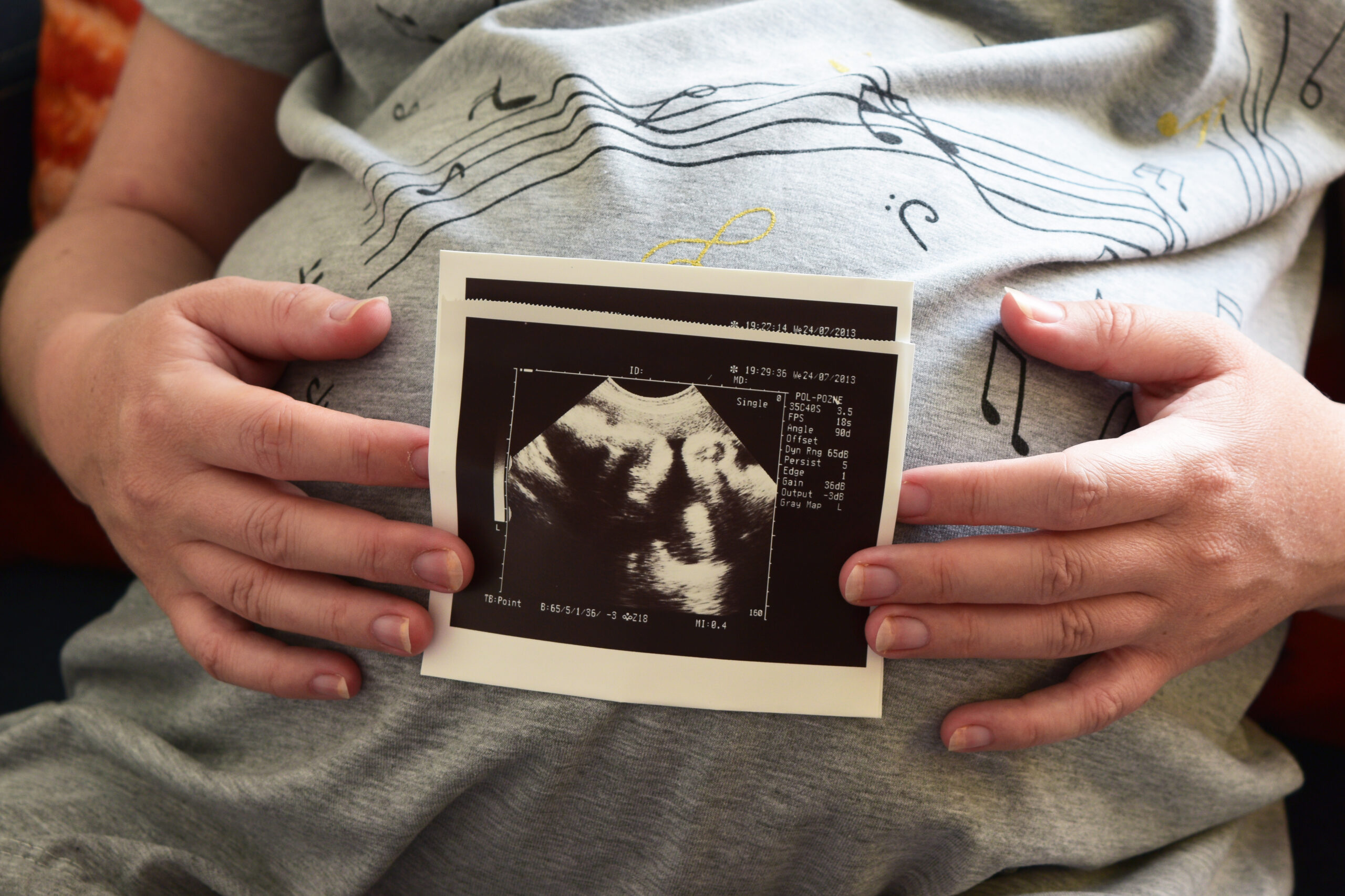 Kilka faktów na temat obowiązującego w Polsce prawa w kontekście śmierci pani Doroty