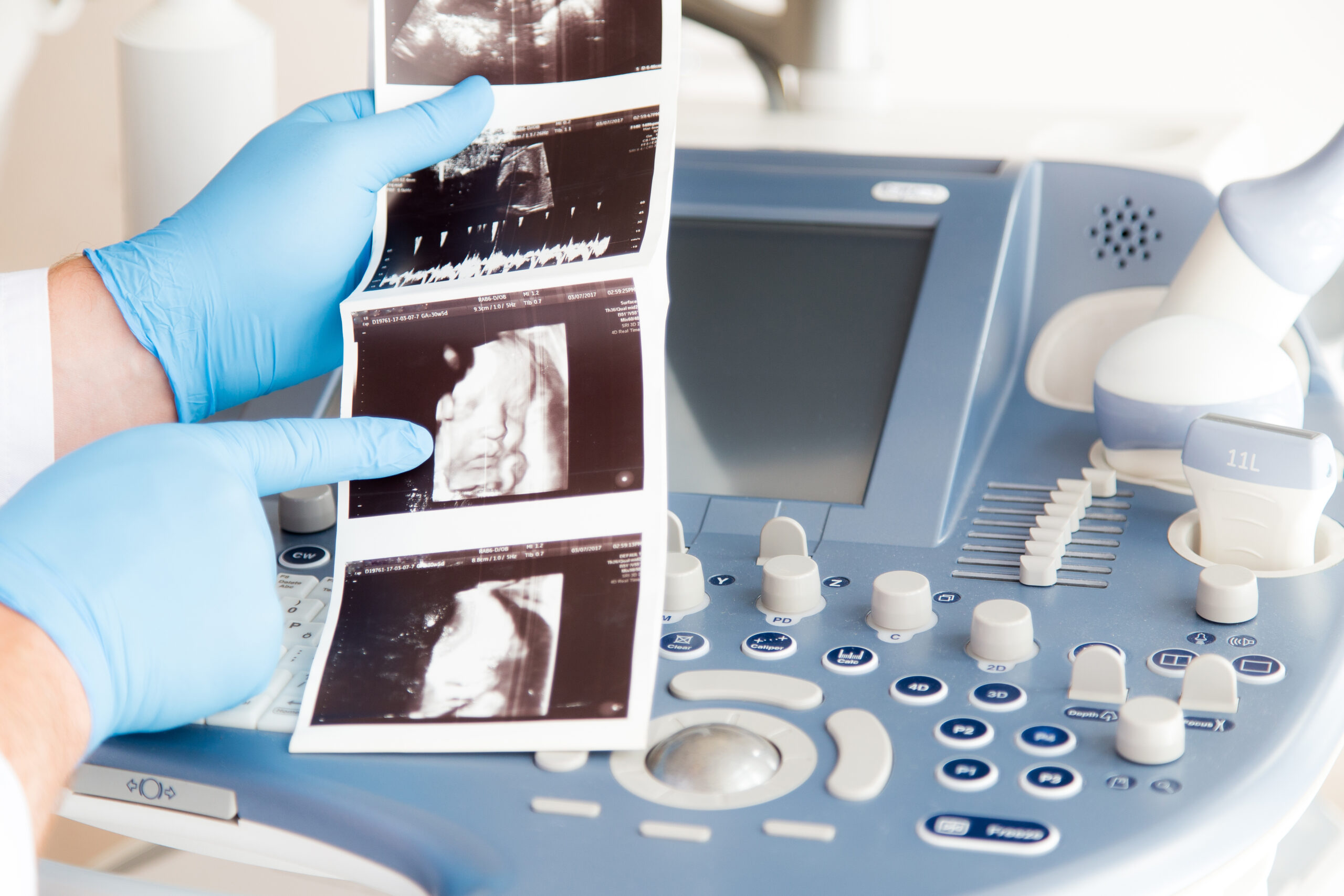 Lekarze nie są zobowiązani do stosowania proaborcyjnych wytycznych Ministerstwa Zdrowia. Analiza Ordo Iuris