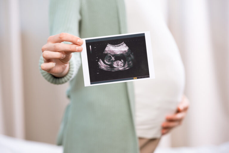 prolife