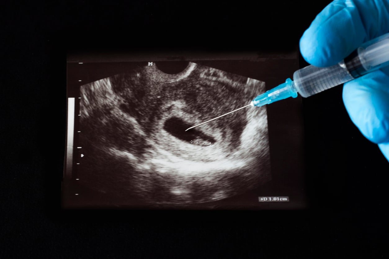 Prawica zawiodła – projekty aborcyjne przegłosowane